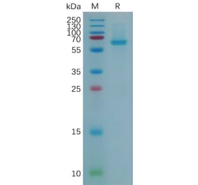 SDS-PAGE - Recombinant Mouse ADAM9 Protein (6×His Tag) (A317534) - Antibodies.com
