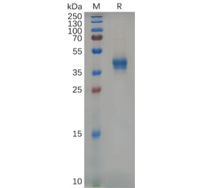 SDS-PAGE - Recombinant Mouse CD38 Protein (6×His Tag) (A317535) - Antibodies.com