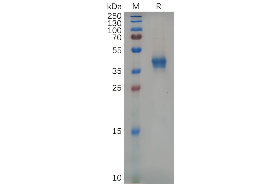 SDS-PAGE - Recombinant Mouse CD38 Protein (6×His Tag) (A317535) - Antibodies.com
