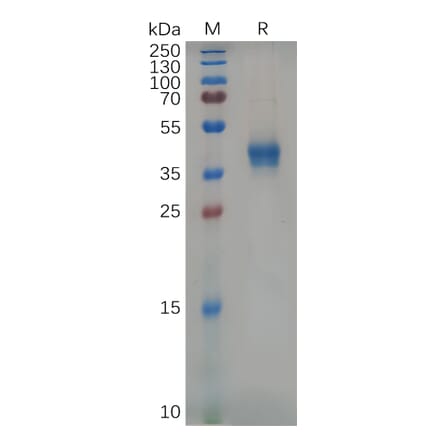 SDS-PAGE - Recombinant Mouse CD38 Protein (6×His Tag) (A317535) - Antibodies.com
