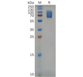 SDS-PAGE - Recombinant Mouse 2B4 Protein (Fc Tag) (A317536) - Antibodies.com