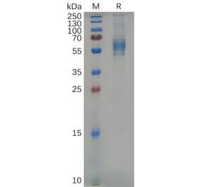 SDS-PAGE - Recombinant Mouse IL3RA/CD123 Protein (6×His Tag) (A317537) - Antibodies.com