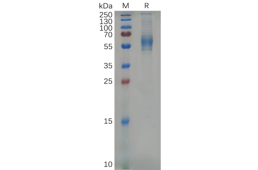 SDS-PAGE - Recombinant Mouse IL3RA/CD123 Protein (6×His Tag) (A317537) - Antibodies.com