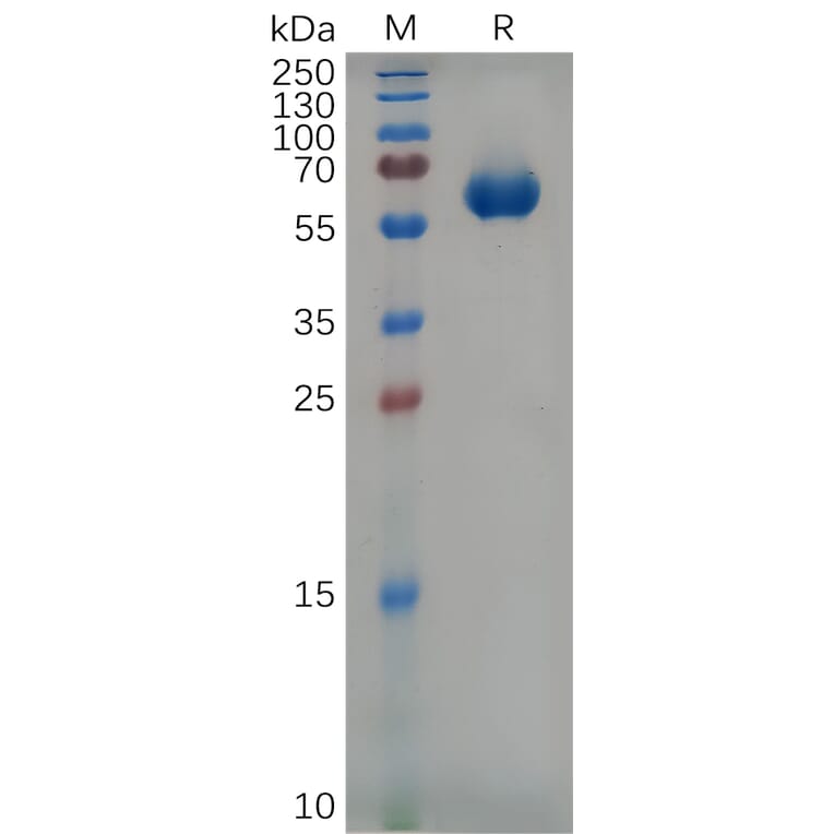 SDS-PAGE - Recombinant Mouse SLAMF7/CS1 Protein (Fc Tag) (A317538) - Antibodies.com