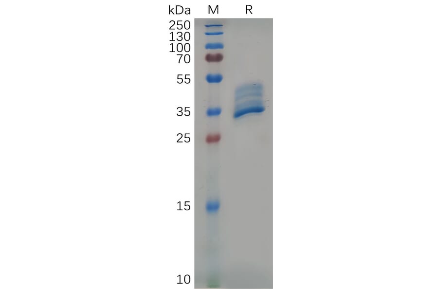 SDS-PAGE - Recombinant Mouse BCMA Protein (Fc Tag) (A317539) - Antibodies.com