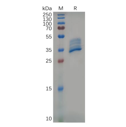 SDS-PAGE - Recombinant Mouse BCMA Protein (Fc Tag) (A317539) - Antibodies.com