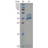 SDS-PAGE - Recombinant Mouse BCMA Protein (Fc Tag) (A317539) - Antibodies.com
