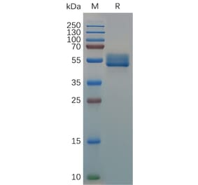 SDS-PAGE - Recombinant Canis lupus familiaris IL18BP Protein (Fc Tag) (A317541) - Antibodies.com