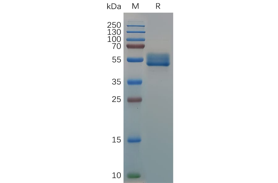 SDS-PAGE - Recombinant Canis lupus familiaris IL18BP Protein (Fc Tag) (A317541) - Antibodies.com