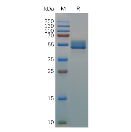 SDS-PAGE - Recombinant Canis lupus familiaris IL18BP Protein (Fc Tag) (A317541) - Antibodies.com