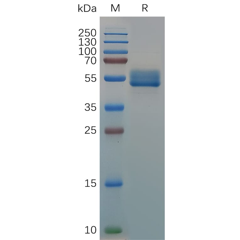 SDS-PAGE - Recombinant Canis lupus familiaris IL18BP Protein (Fc Tag) (A317541) - Antibodies.com