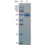 SDS-PAGE - Recombinant Canis lupus familiaris IL18BP Protein (Fc Tag) (A317541) - Antibodies.com