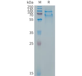 SDS-PAGE - Recombinant Cynomolgus macaque SELPLG Protein (6×His Tag) (A317542) - Antibodies.com