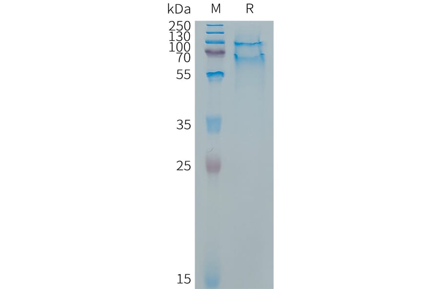 SDS-PAGE - Recombinant Cynomolgus macaque SELPLG Protein (6×His Tag) (A317542) - Antibodies.com