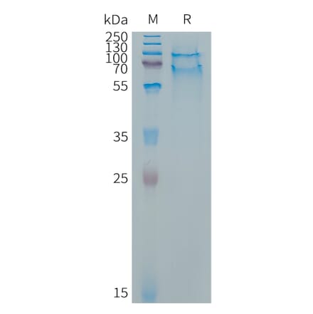 SDS-PAGE - Recombinant Cynomolgus macaque SELPLG Protein (6×His Tag) (A317542) - Antibodies.com