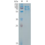 SDS-PAGE - Recombinant Cynomolgus macaque SELPLG Protein (6×His Tag) (A317542) - Antibodies.com