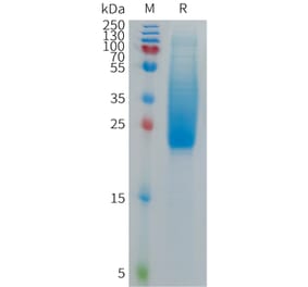 SDS-PAGE - Recombinant Cynomolgus macaque IL18BP Protein (6×His Tag) (A317543) - Antibodies.com