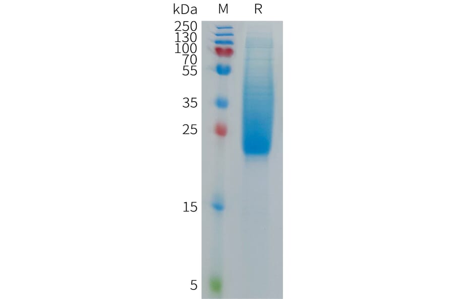 SDS-PAGE - Recombinant Cynomolgus macaque IL18BP Protein (6×His Tag) (A317543) - Antibodies.com