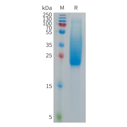 SDS-PAGE - Recombinant Cynomolgus macaque IL18BP Protein (6×His Tag) (A317543) - Antibodies.com