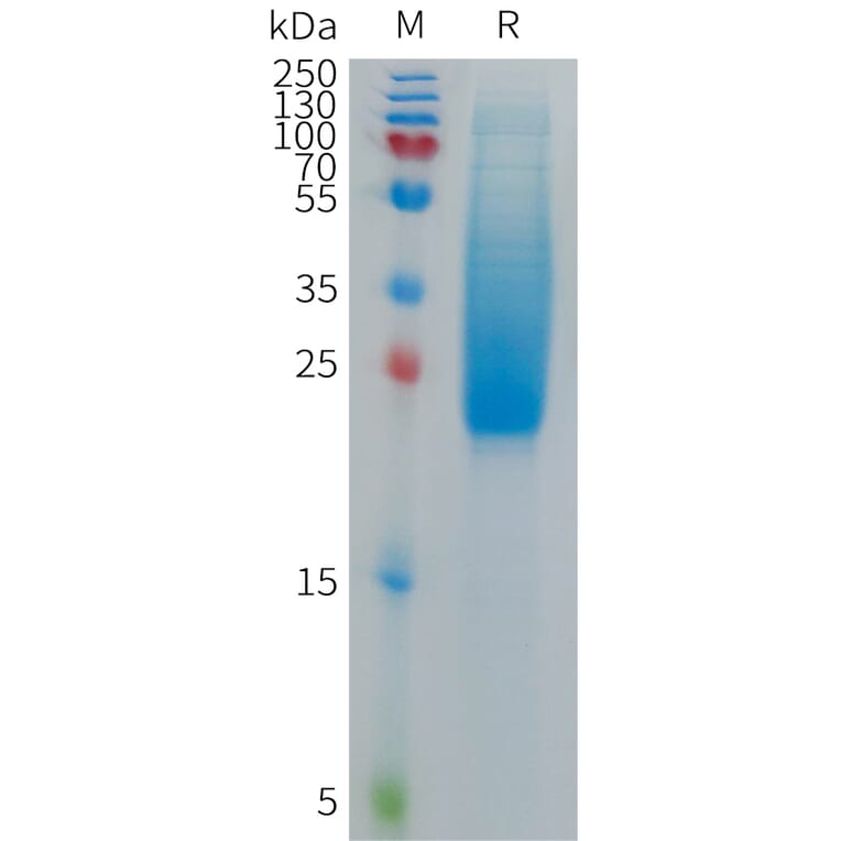 SDS-PAGE - Recombinant Cynomolgus macaque IL18BP Protein (6×His Tag) (A317543) - Antibodies.com
