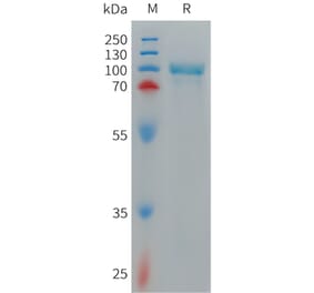 SDS-PAGE - Recombinant Cynomolgus macaque CD93 Protein (6×His Tag) (A317544) - Antibodies.com