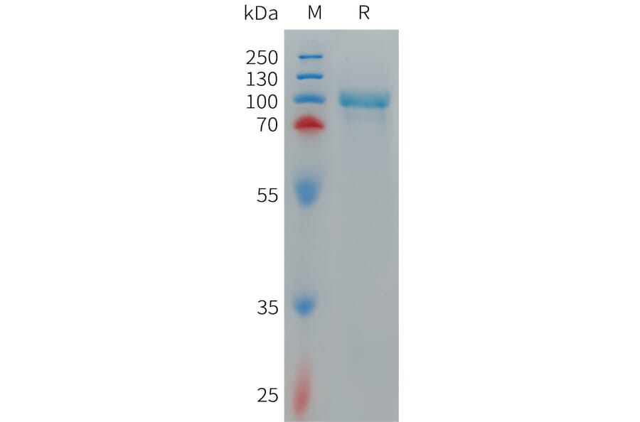 SDS-PAGE - Recombinant Cynomolgus macaque CD93 Protein (6×His Tag) (A317544) - Antibodies.com