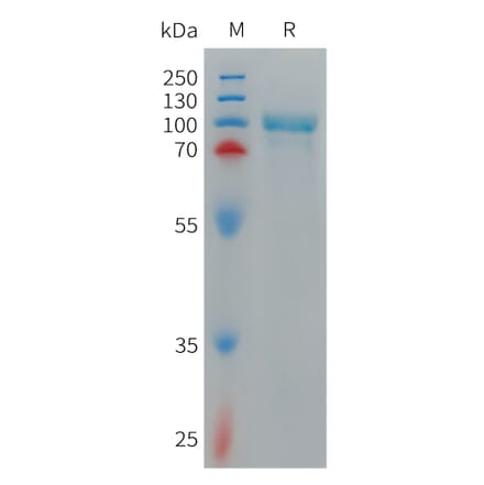 SDS-PAGE - Recombinant Cynomolgus macaque CD93 Protein (6×His Tag) (A317544) - Antibodies.com