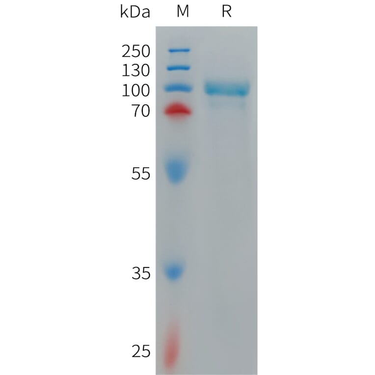 SDS-PAGE - Recombinant Cynomolgus macaque CD93 Protein (6×His Tag) (A317544) - Antibodies.com