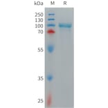 SDS-PAGE - Recombinant Cynomolgus macaque CD93 Protein (6×His Tag) (A317544) - Antibodies.com