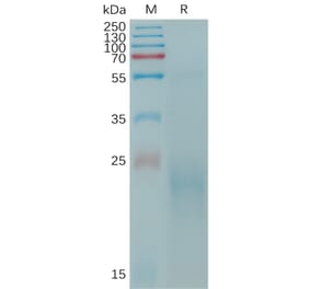 SDS-PAGE - Recombinant Cynomolgus macaque CLEC4C Protein (6×His Tag) (A317545) - Antibodies.com