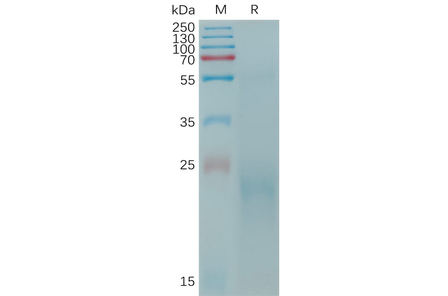 SDS-PAGE - Recombinant Cynomolgus macaque CLEC4C Protein (6×His Tag) (A317545) - Antibodies.com