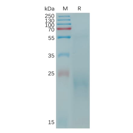 SDS-PAGE - Recombinant Cynomolgus macaque CLEC4C Protein (6×His Tag) (A317545) - Antibodies.com