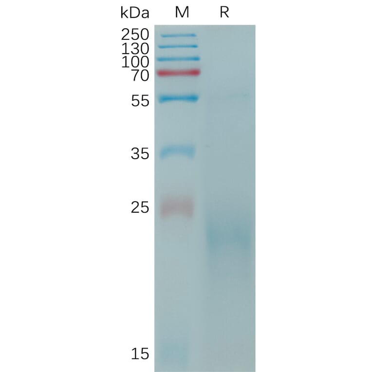 SDS-PAGE - Recombinant Cynomolgus macaque CLEC4C Protein (6×His Tag) (A317545) - Antibodies.com