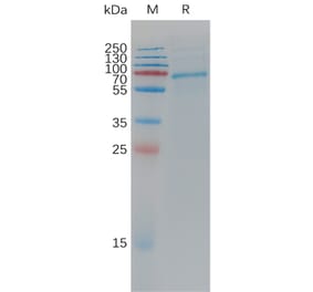 SDS-PAGE - Recombinant Cynomolgus macaque ADAM9 Protein (6×His Tag) (A317546) - Antibodies.com