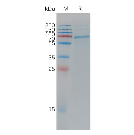 SDS-PAGE - Recombinant Cynomolgus macaque ADAM9 Protein (6×His Tag) (A317546) - Antibodies.com