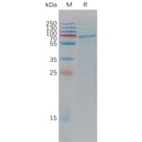 SDS-PAGE - Recombinant Cynomolgus macaque ADAM9 Protein (6×His Tag) (A317546) - Antibodies.com