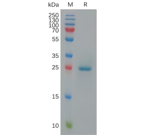 SDS-PAGE - Recombinant Cynomolgus macaque BTN3A1 Protein (6×His Tag) (A317547) - Antibodies.com