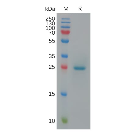 SDS-PAGE - Recombinant Cynomolgus macaque BTN3A1 Protein (6×His Tag) (A317547) - Antibodies.com