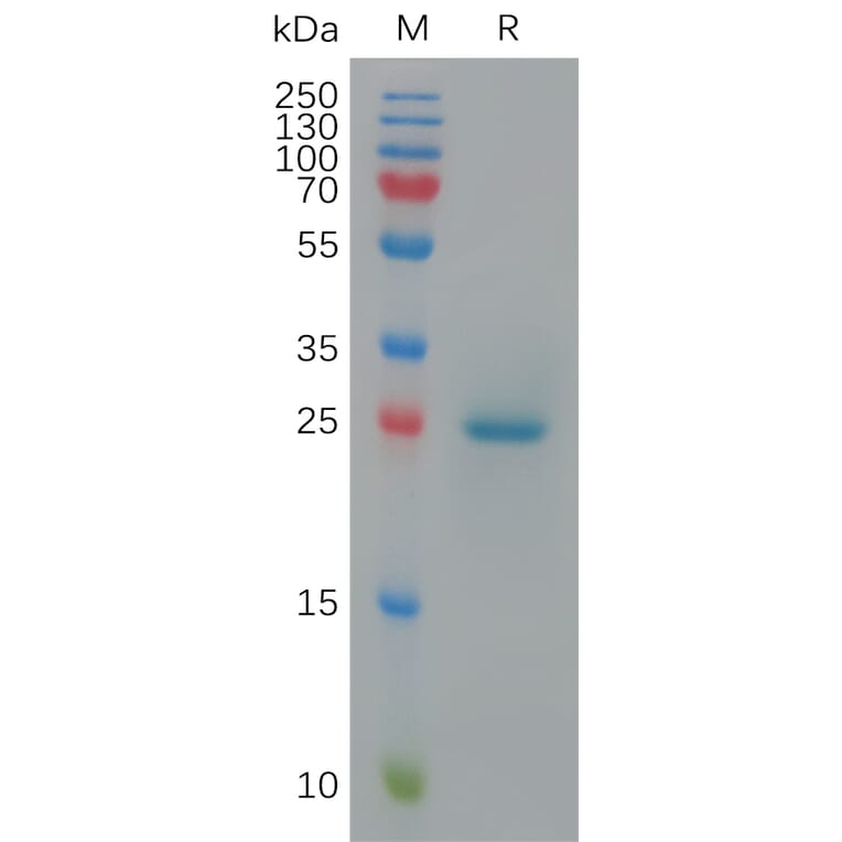 SDS-PAGE - Recombinant Cynomolgus macaque BTN3A1 Protein (6×His Tag) (A317547) - Antibodies.com