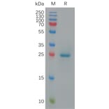 SDS-PAGE - Recombinant Cynomolgus macaque BTN3A1 Protein (6×His Tag) (A317547) - Antibodies.com
