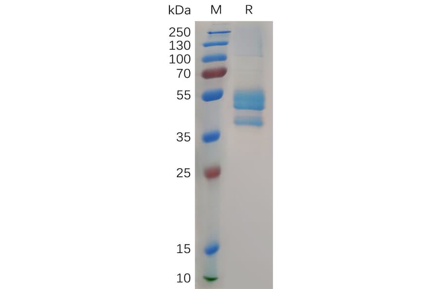 SDS-PAGE - Recombinant Cynomolgus macaque Eotaxin 2 Protein (Fc Tag) (A317548) - Antibodies.com