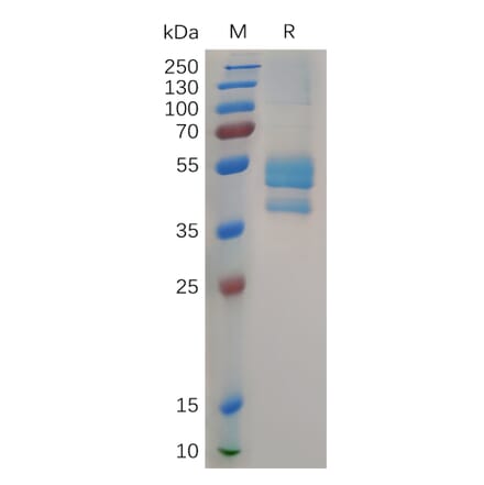 SDS-PAGE - Recombinant Cynomolgus macaque Eotaxin 2 Protein (Fc Tag) (A317548) - Antibodies.com