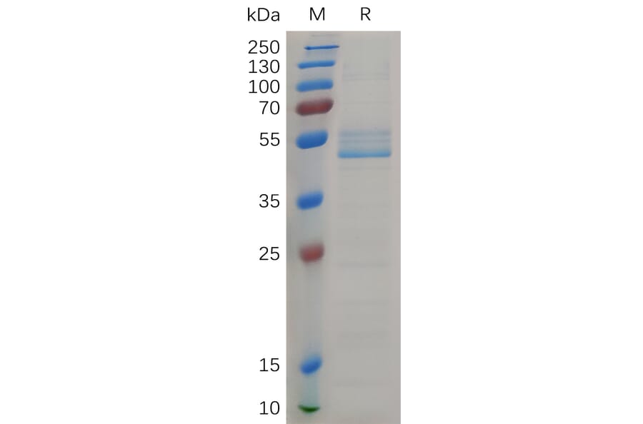 SDS-PAGE - Recombinant Cynomolgus macaque Midkine Protein (Fc Tag) (A317549) - Antibodies.com