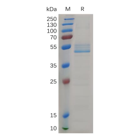 SDS-PAGE - Recombinant Cynomolgus macaque Midkine Protein (Fc Tag) (A317549) - Antibodies.com