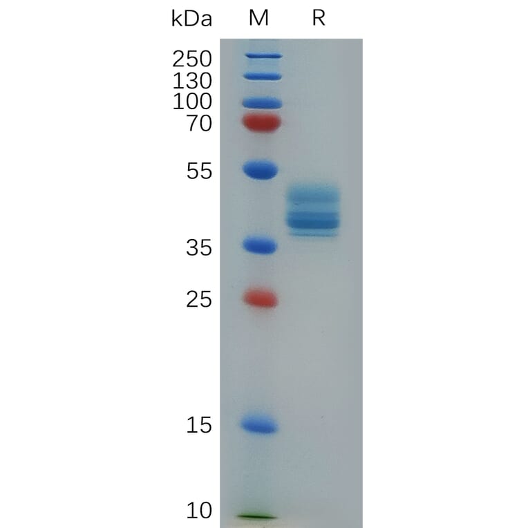 SDS-PAGE - Recombinant Cynomolgus macaque Annexin-2/ANXA2 Protein (6×His Tag) (A317550) - Antibodies.com