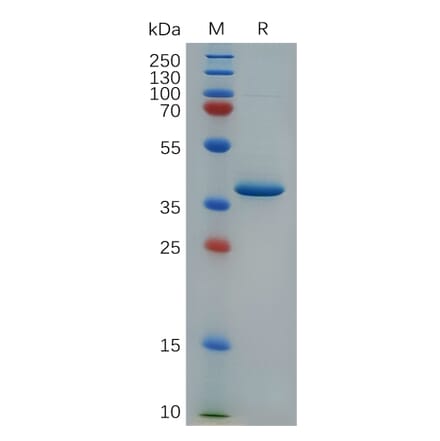 SDS-PAGE - Recombinant Cynomolgus macaque PF4 Protein (Fc Tag) (A317551) - Antibodies.com