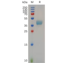 SDS-PAGE - Recombinant Cynomolgus macaque CCR8 Protein (Fc Tag) (A317552) - Antibodies.com