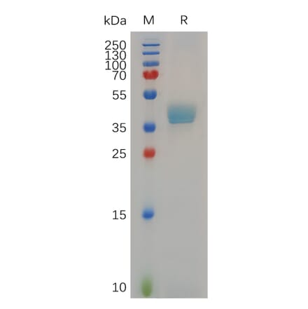SDS-PAGE - Recombinant Cynomolgus macaque CCR8 Protein (Fc Tag) (A317552) - Antibodies.com
