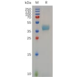 SDS-PAGE - Recombinant Cynomolgus macaque CCR8 Protein (Fc Tag) (A317552) - Antibodies.com