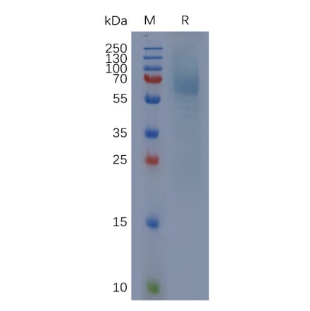 SDS-PAGE - Recombinant Cynomolgus macaque IgHE Protein (6×His Tag) (A317553) - Antibodies.com